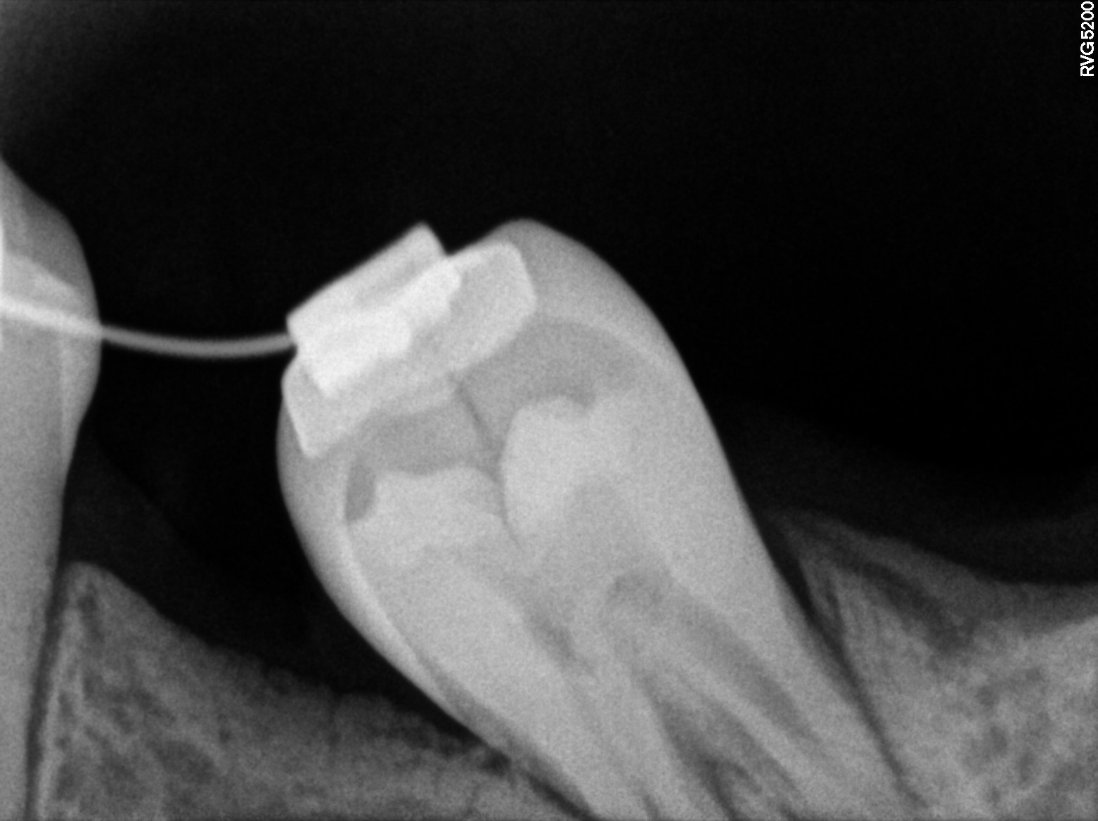 Dental X-ray